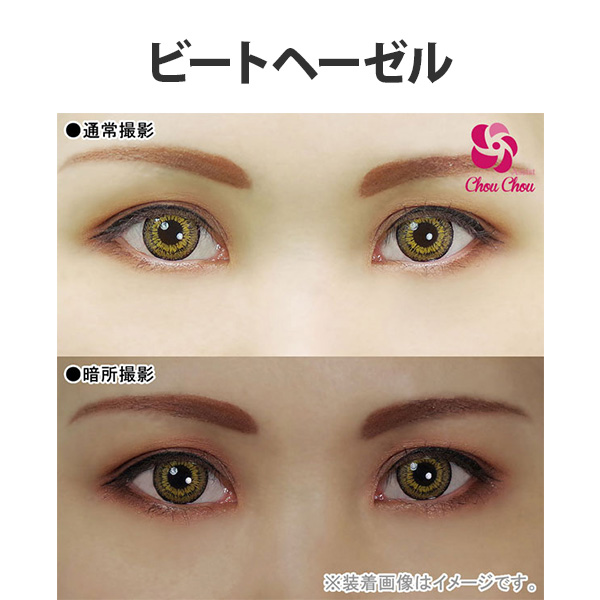 アシストシュシュ ツインループワンデー装用写真