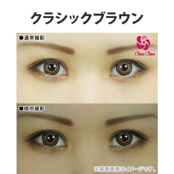 アシストシュシュ ツインループワンデー装用写真